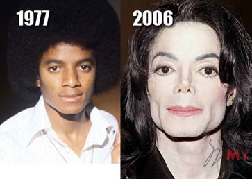 Майкл Джексон – самая знаменитая жертва пластики