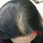 Мазь против выпадения волос