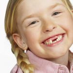 Что нужно знать о смене молочных зубов на постоянные у ребенка