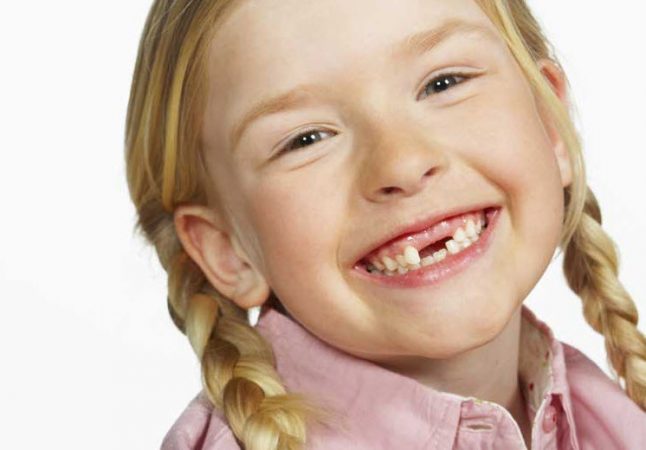 Молочные зубы начинают выпадать в пять-шесть лет (фото: StomatologForAll.ru)