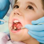 Кариес молочных зубов у детей раннего возраста: лечение, особенности протекания, профилактика