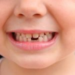 Есть ли нервы в молочных зубах