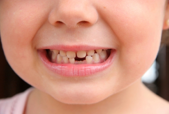 Первый молочный зуб – это настоящее событие для всей семьи (фото: www.stomatologforall.ru)