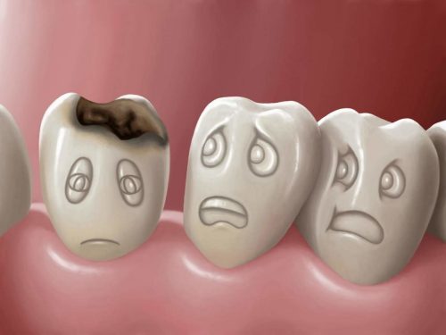 Многие стоматологи специализируются именно на лечении детского кариеса (фото: www.artstom.ru)