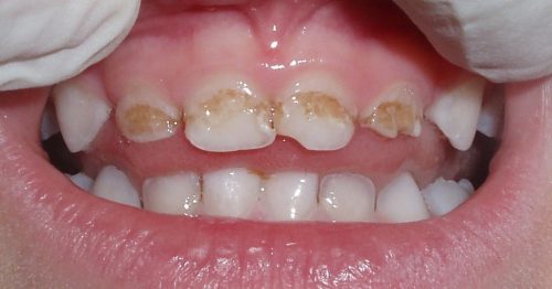 Рекомендуется посещать стоматолога минимум 2 раза в году (фото: www.newvel.spb.ru)