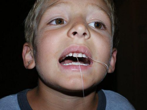 Шатающийся зуб нужно выдергивать резким движением вверх (фото: www.ozubkah.ru)