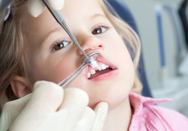 Для детей смена молочных зубов – особенное событие (фото: www.smartdentistry.com.ua)