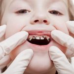 Что делать, если у ребенка портятся молочные зубы