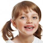 Молочные зубы у детей: схема выпадения