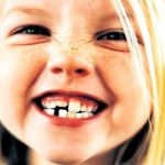 Сколько молочных зубов должно быть у детей