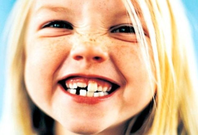 Необходимо знать, сколько молочных зубов у человека (фото: spyashhie-deti.ru)