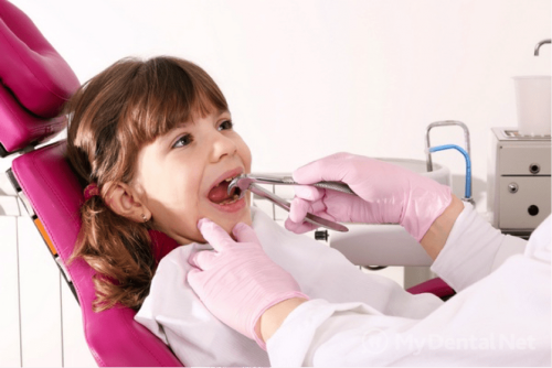 Из-за свища маленькой пациентке удаляют зуб (фото: www.vip-line.com.ua)