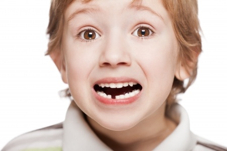Выпадение молочных зубов не должно стать шоком для ребенка (фото: deltadent.es)